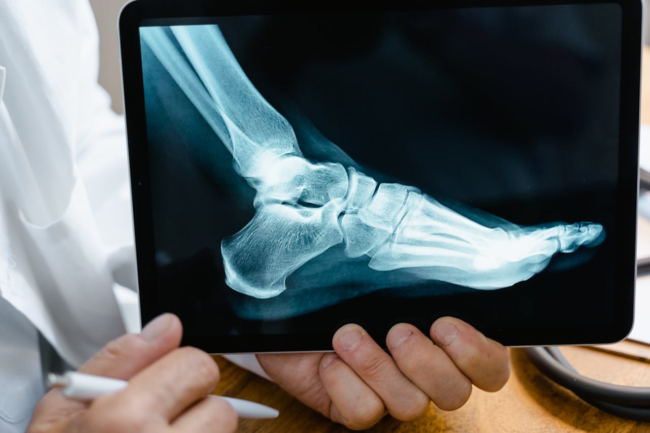 personal injury lawyer florida